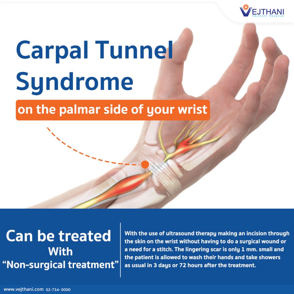 Non-surgical treatment option for Carpal Tunnel Syndrome - Vejthani  Hospital