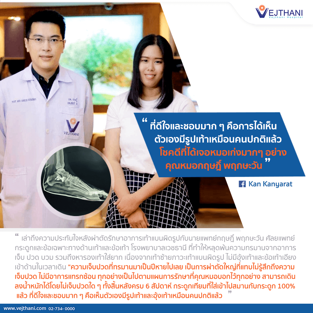 รักษาเท้าผิดรูป