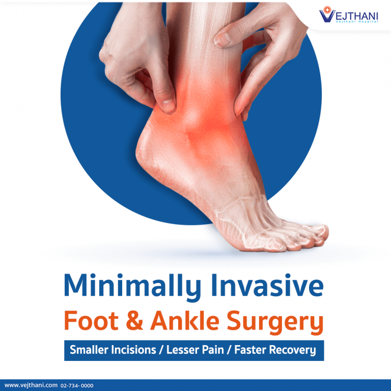 All about Foot disease