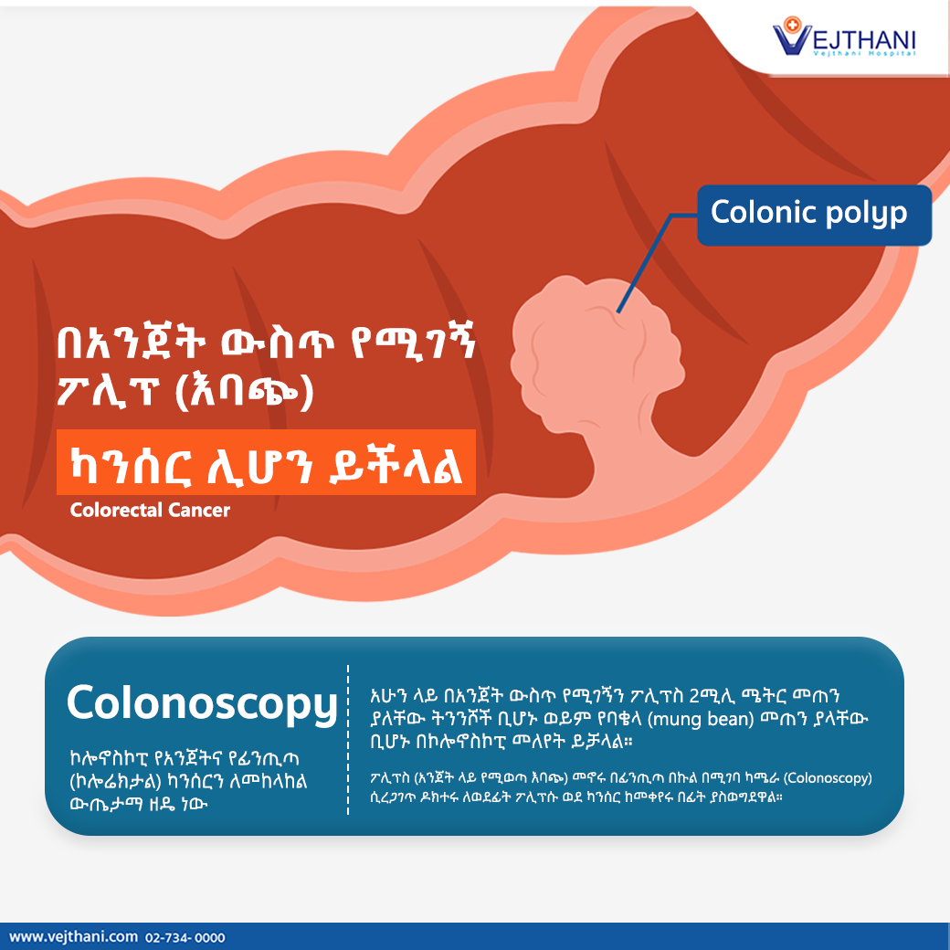 በአንጀት ውስጥ የሚገኝ ፖሊፕ (እባጭ) ካንሰር ሊሆን ይችላል (Colorectal cancer) - Vejthani  Hospital