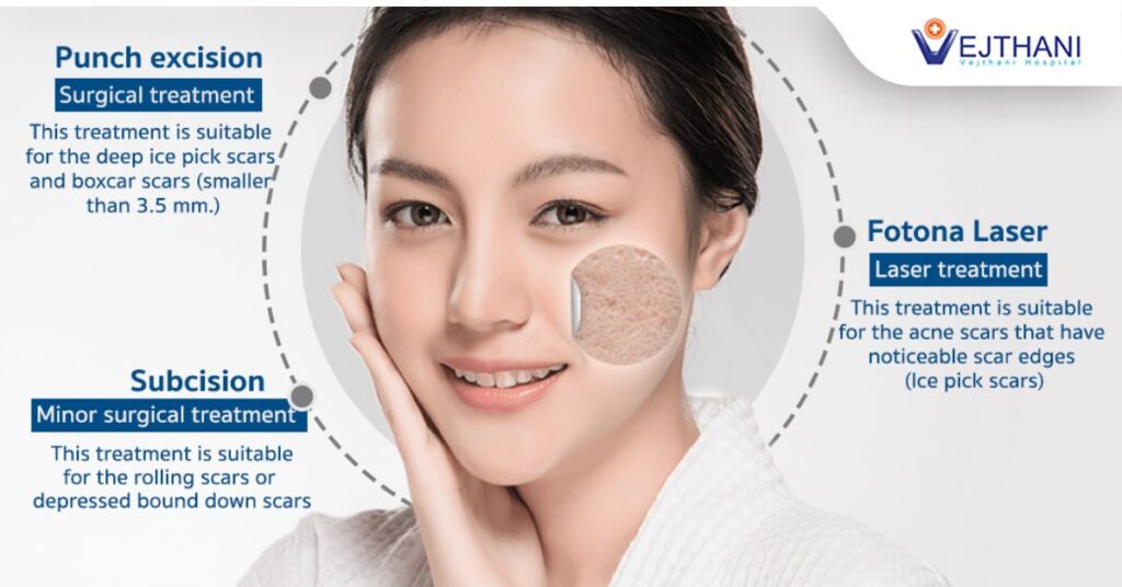 ACNE AND LEAKY GUT SYNDROME