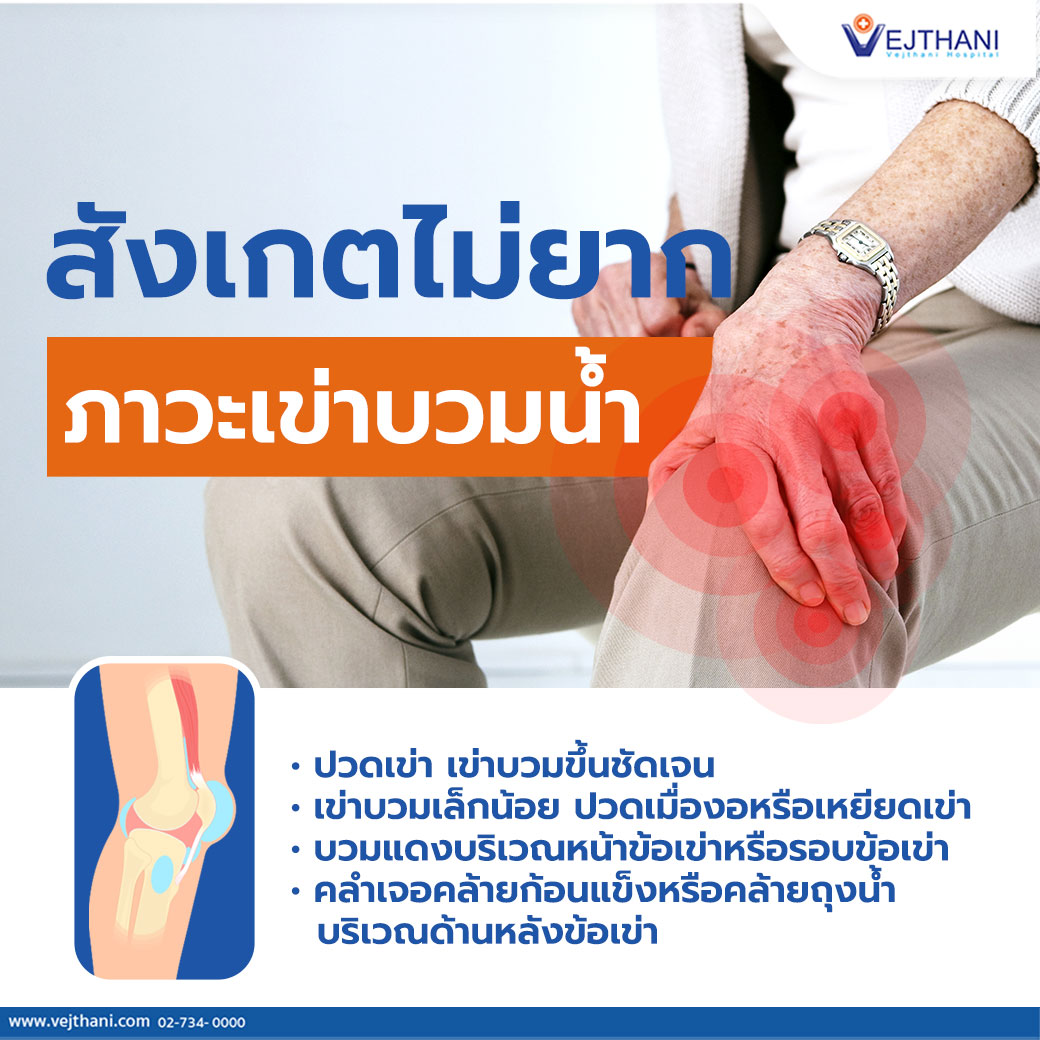 สังเกตไม่ยาก...ภาวะเข่าบวมน้ำ - โรงพยาบาลเวชธานี สังเกตไม่ยาก...ภาวะเข่าบวมน้ำ - โรงพยาบาลเวชธานี