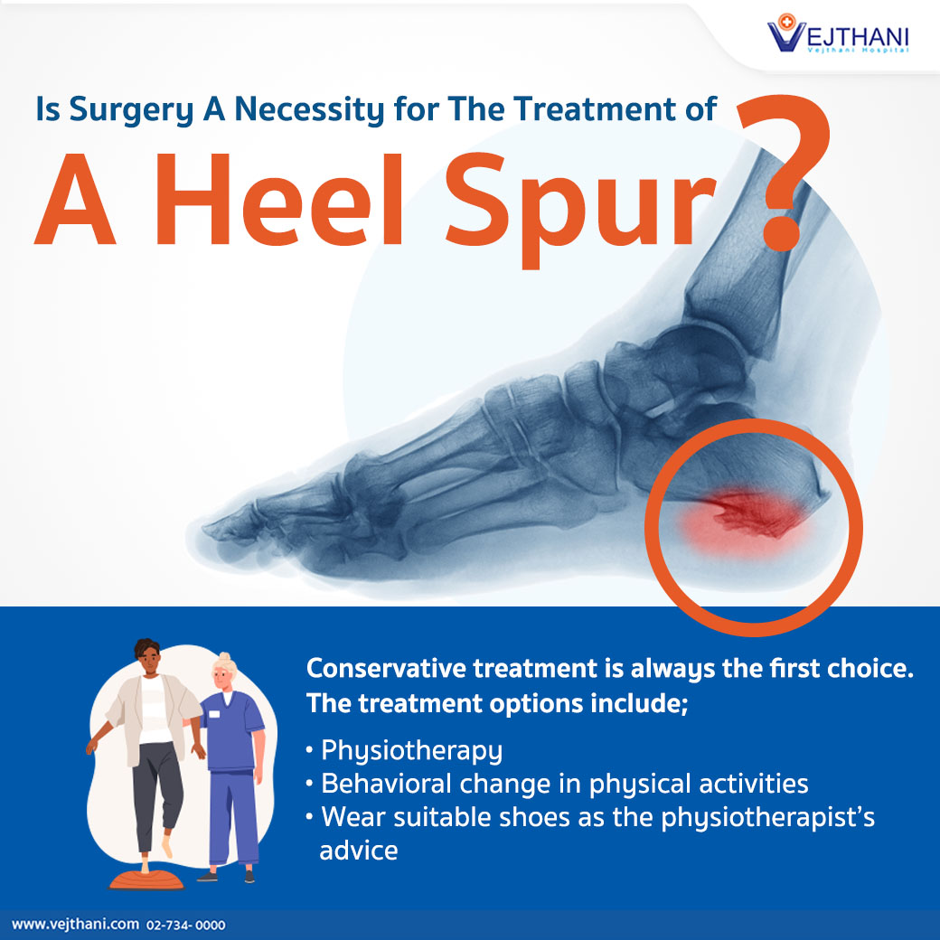 Is Surgery A Necessity for The Treatment of A Heel Spur