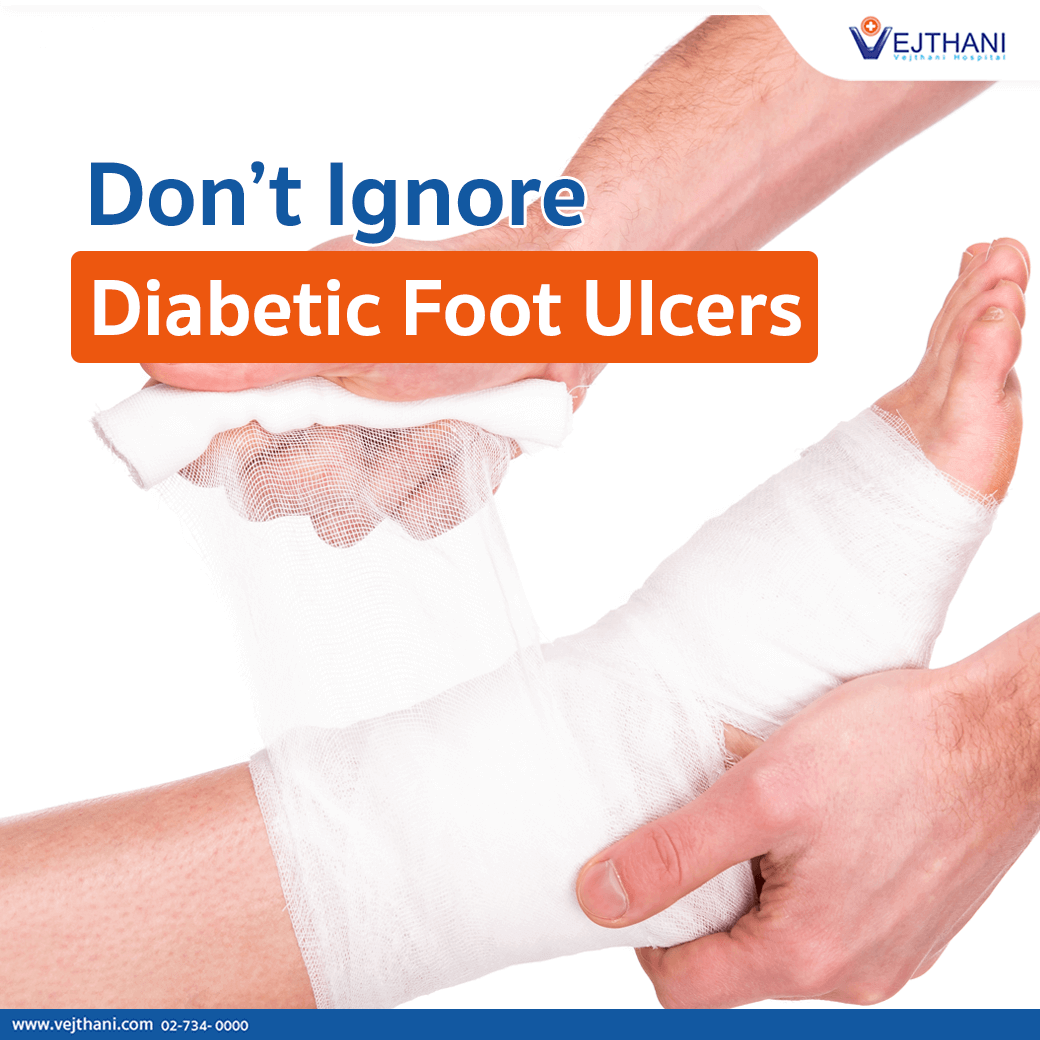 Never ignore a diabetic foot ulcer. A diabetic foot ulcer is a wound, or  sore, on the foot of someone living with diabetes. Please feel… | Instagram