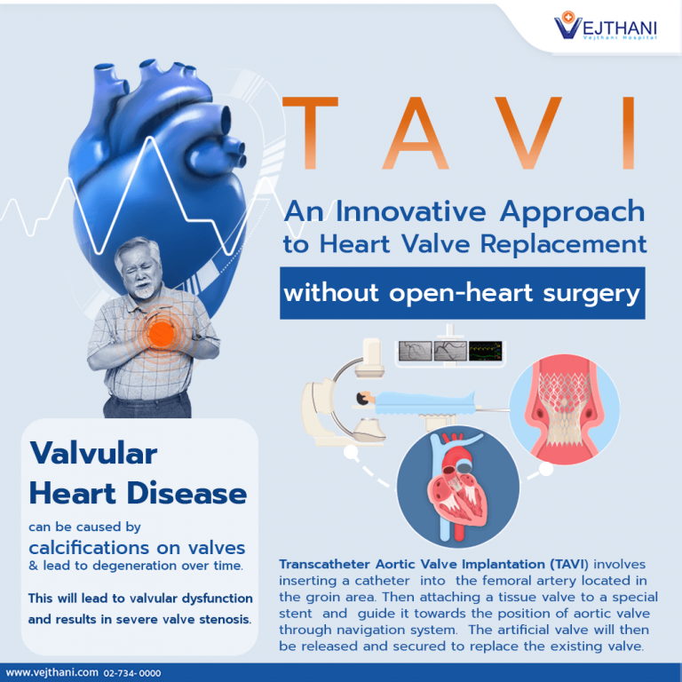 TAVI is a new approach to heart valve replacement.