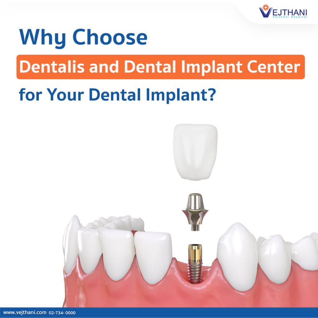 Get Dental Implants in Thailand at Vejthani Hospital.