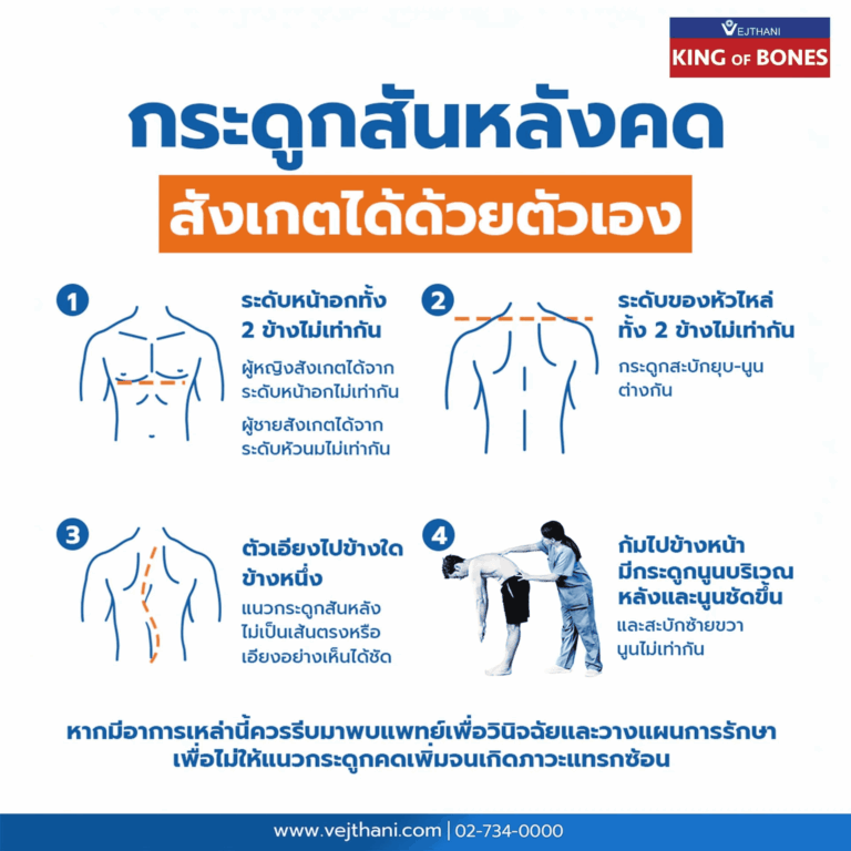 กระดูกสันหลังคด