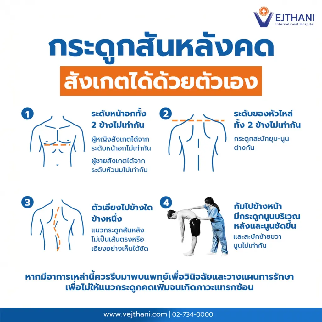 กระดูกสันหลังคด