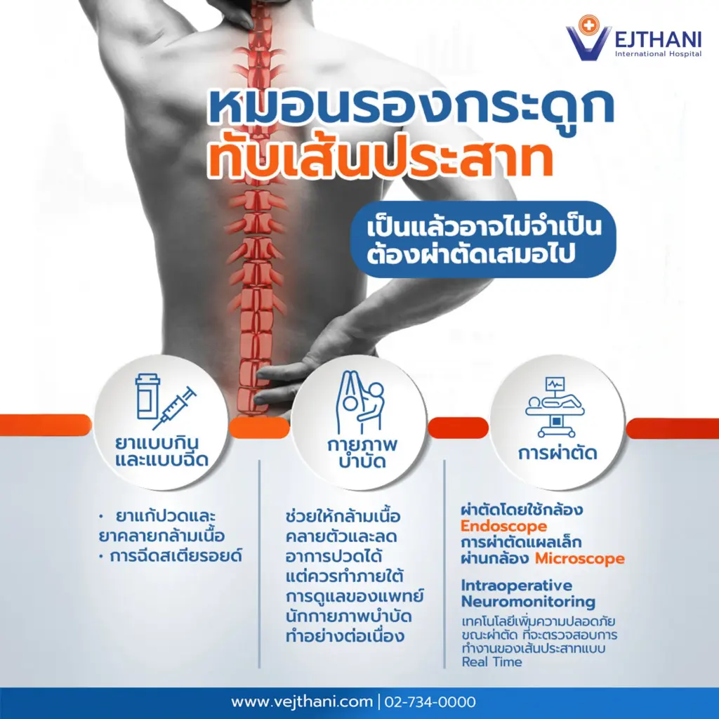 หมอนรองกระดูกทับเส้นประสาท