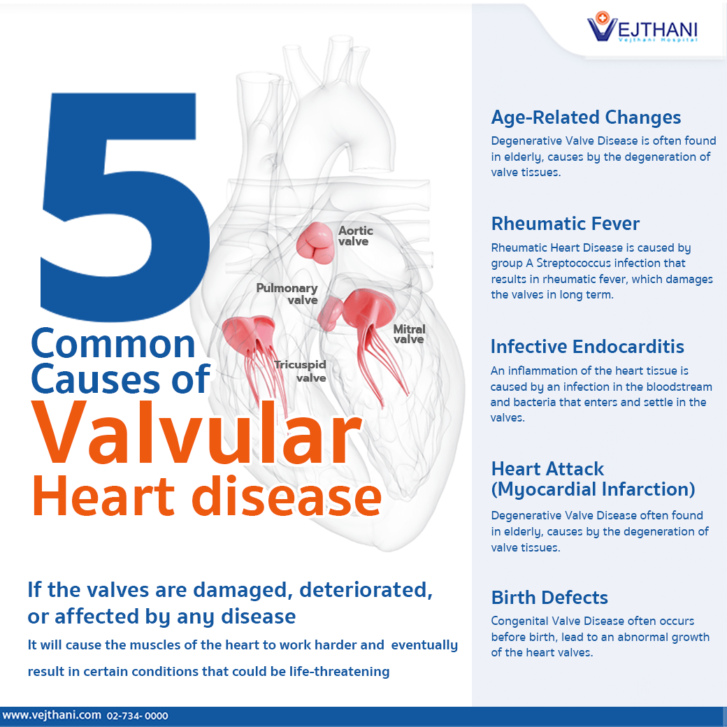 ¿Cuál es el trastorno de la válvula cardíaca más común?