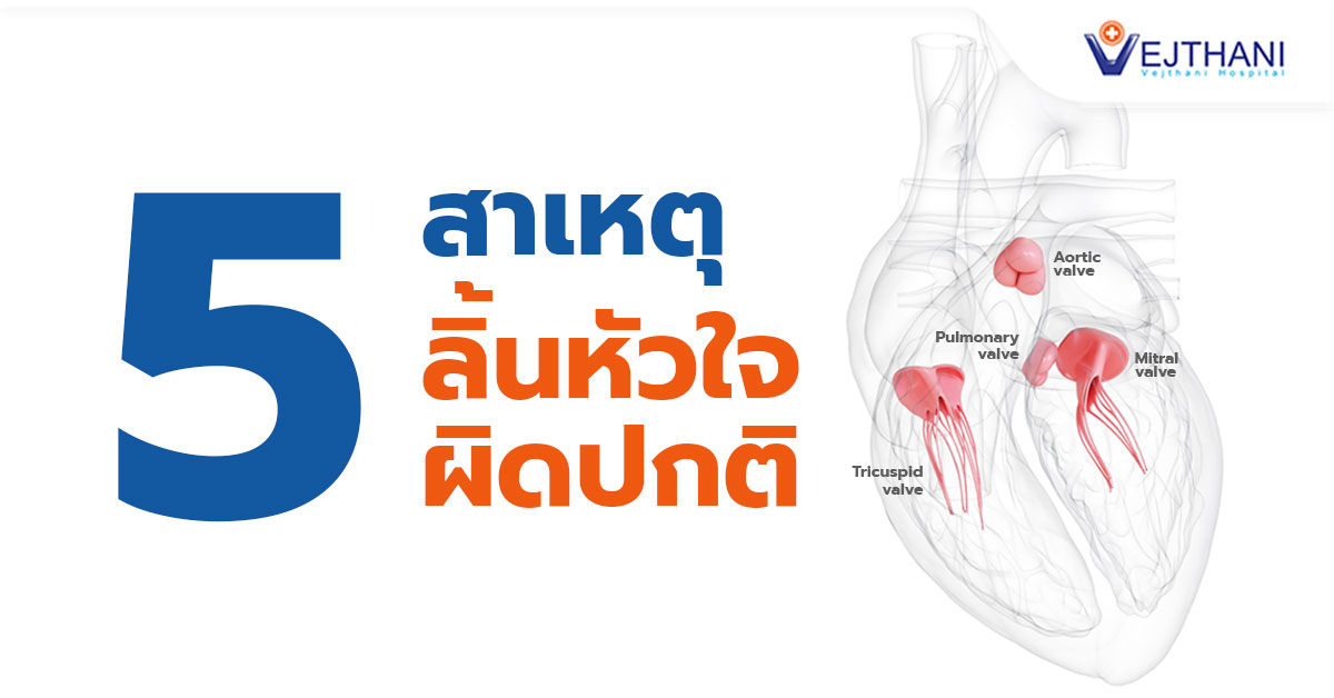 ลิ้นหัวใจเสื่อม