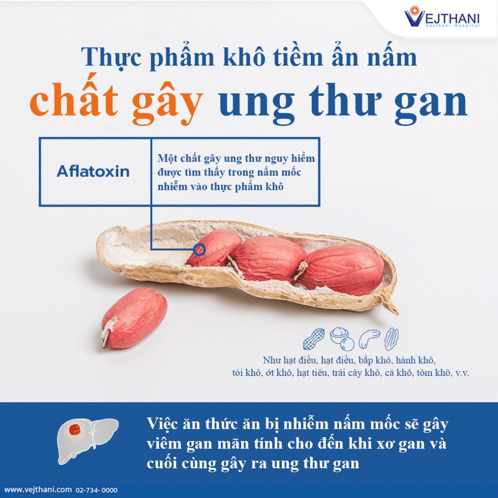 Thông tin về ăn hạt điều đối với người bị ung thư