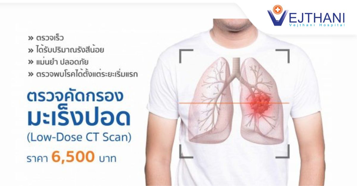 ตรวจคัดกรองมะเร็งปอด
