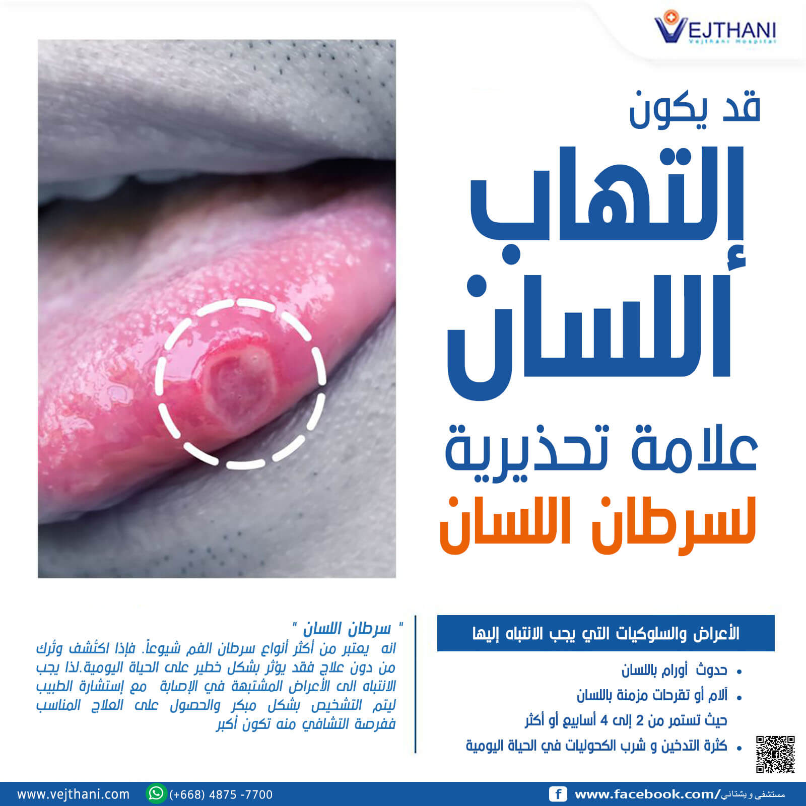 قد يكون إلتهاب اللسان علامة تحذيرية لسرطان اللسان - Vejthani Hospital