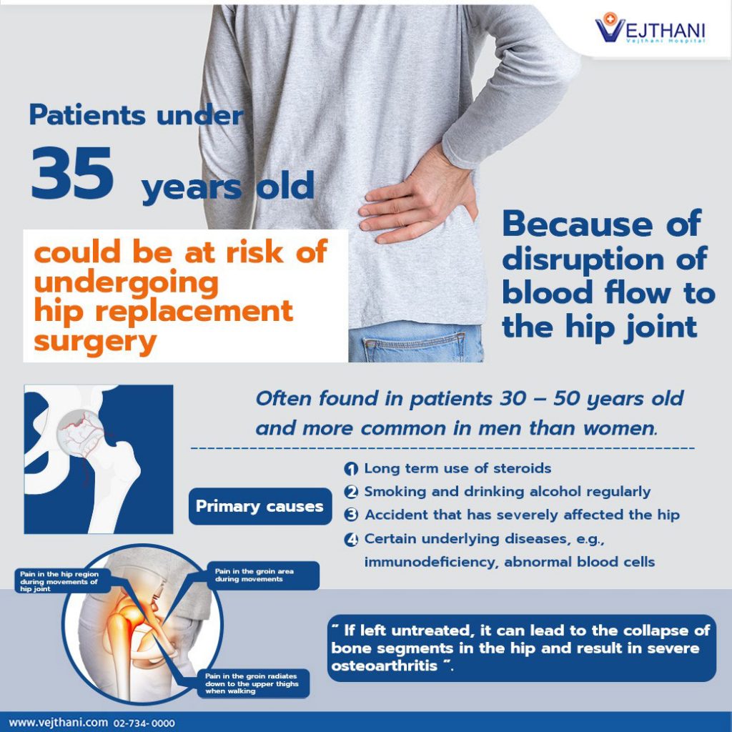 Patients with Osteonecrosis of hip could be at risk of undergoing hip  replacement surgery - Vejthani Hospital | JCI Accredited International  Hospital in Bangkok, Thailand.