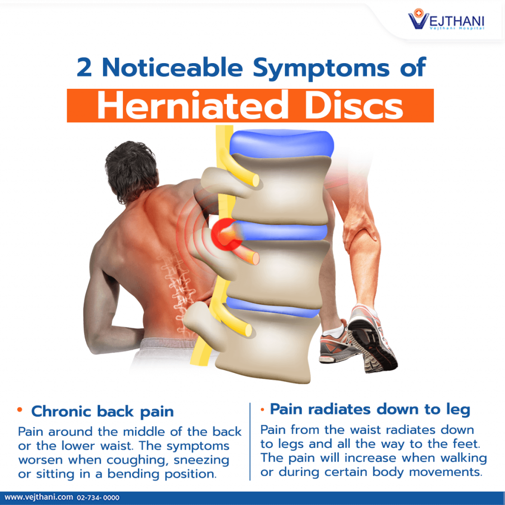 https://www.vejthani.com/wp-content/uploads/2022/03/2-Noticeable-Symptoms-of-Herniated-Discs-1024x1024.png