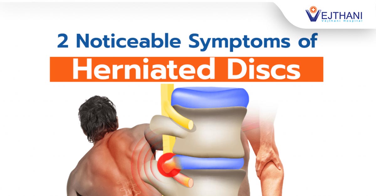 2 Noticeable Symptoms of Herniated Discs