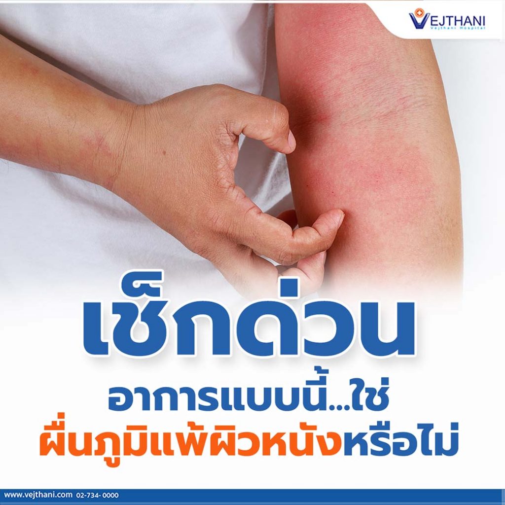 ผื่นภูมิแพ้ผิวหนัง เกิดจาก