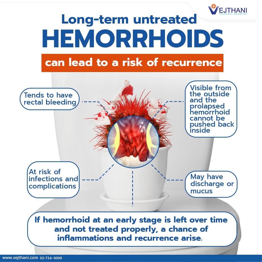 Although hemorrhoid does not seem like a dangerous disease, it creates a nuisance when defecating and itches during the day. There is a chance of inflammations and for symptoms to occur again if a hemorrhoid is left untreated for a long time or treated improperly.