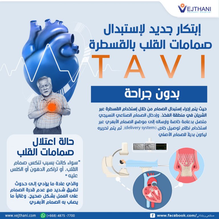 Transcatheter Aortic Valve Implantation (TAVI),