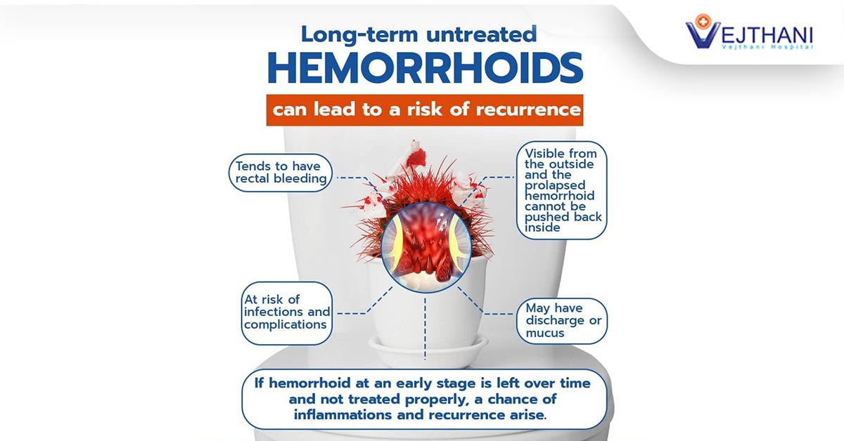 Longterm untreated Hemorrhoids can lead to a risk of recurrence