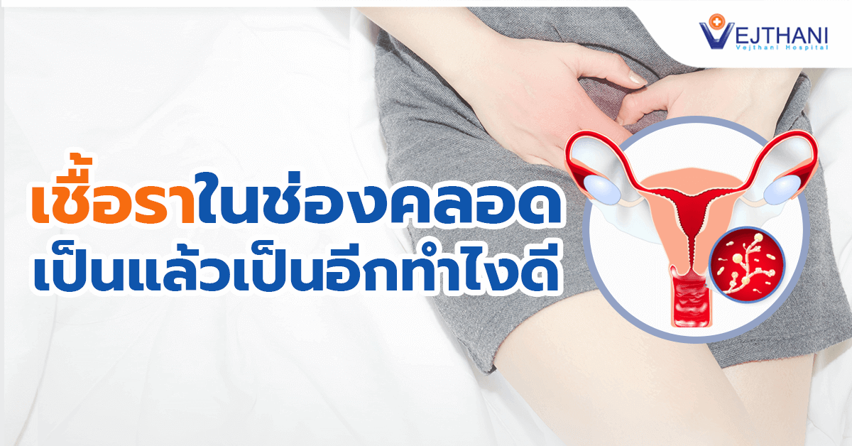 ติดเชื้อในช่องคลอด วิธีรักษา