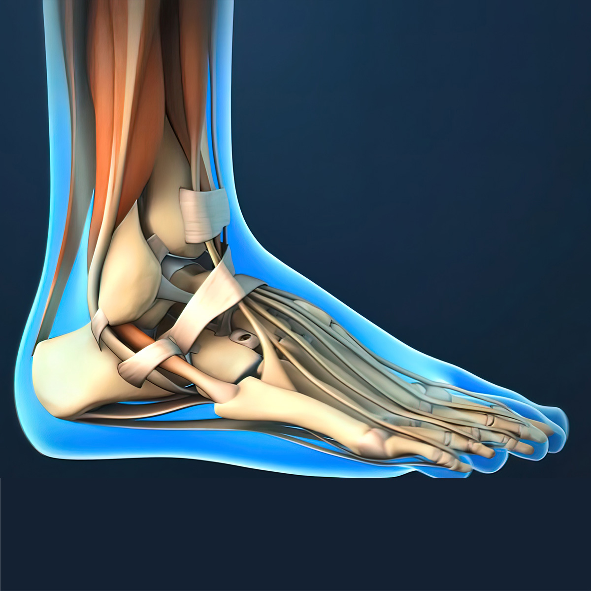 Arthritis in heel bone shop
