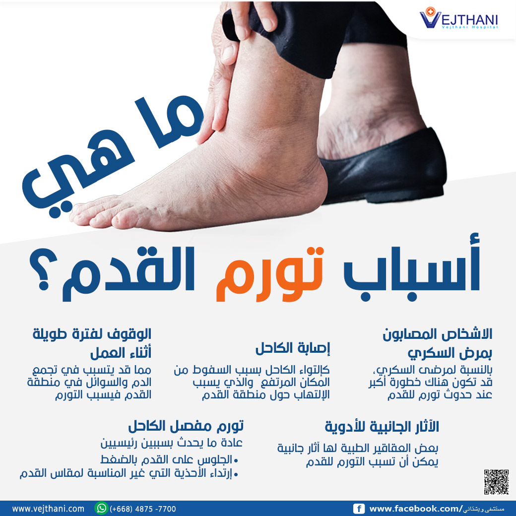 What causes swollen feet