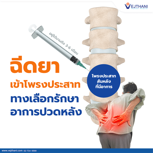 ฉีดยาเข้าโพรงประสาท ทางเลือกรักษาอาการปวดหลัง - โรงพยาบาลเวชธานี ฉีดยาเข้าโพรงประสาท ทางเลือกรักษาอาการปวดหลัง - โรงพยาบาลเวชธานี