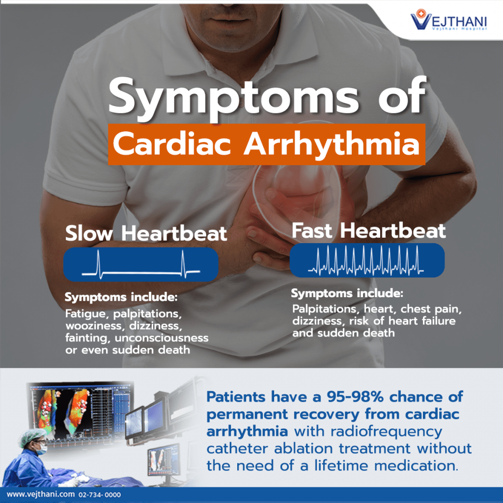 Arrhythmias - Treatments - Swiss Ablation