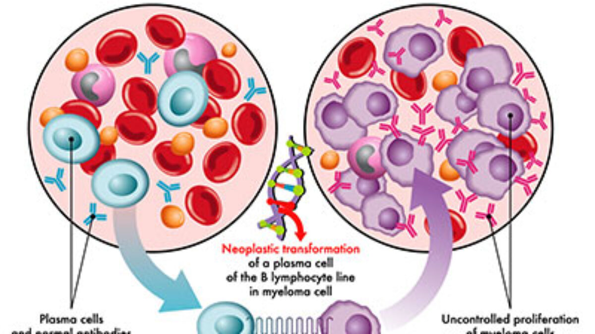 glutathione mnemonic An Under Recognised Cause of Metabolic Acidosis