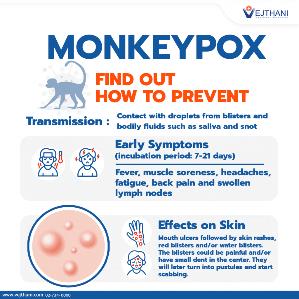 How to prevent monkeypox - divisionhouse21