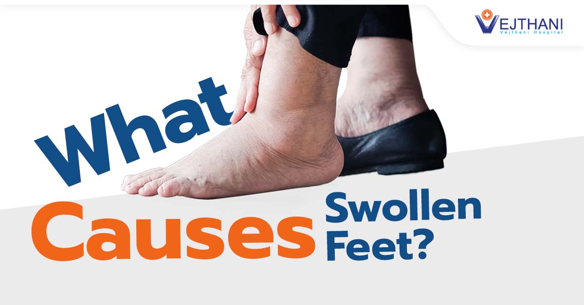 What Causes Swollen Feet? - Vejthani Hospital  JCI Accredited  International Hospital in Bangkok, Thailand.