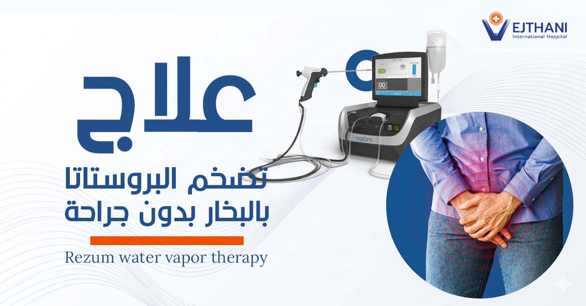 علاج تضخم البروستاتا بالبخار بدون جراحة