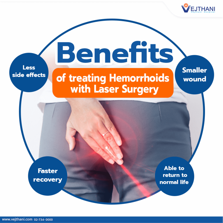 Benefits of Treating Hemorrhoids with Laser Surgery