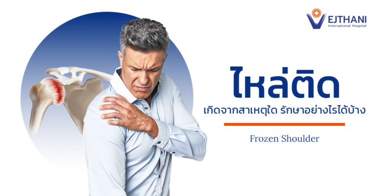 ไหล่ติด ยกแขนไม่ขึ้น