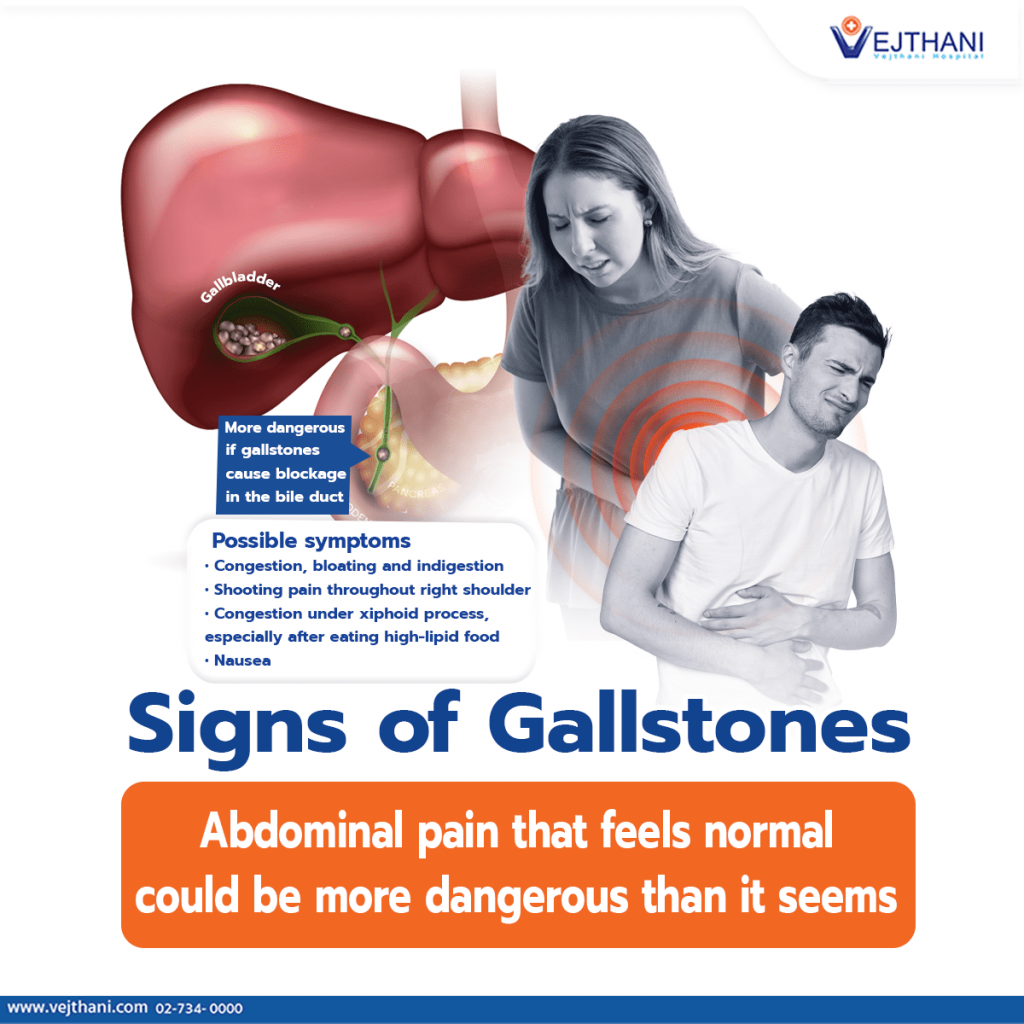 Signs sales of gallstones