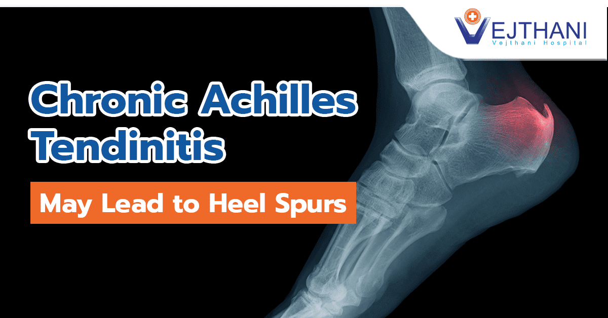 thumbnail image 2 of Pedimend™ Heel Wrap - Cushions Heel Spurs, Plantar Fasciitis, Cracked Heels (Black) 2 of 3