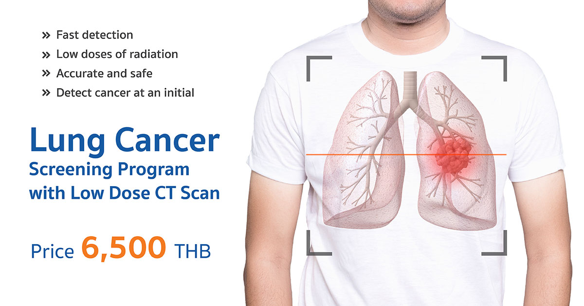 Lung Cancer Screening Program with Low Dose CT Scan