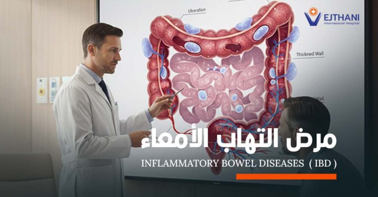 مرض التهاب الأمعاء