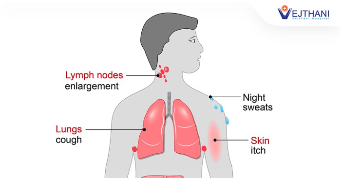 Lymphoma is cancer of the lymphatic system.