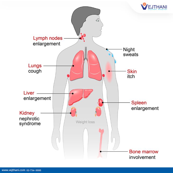 Lymphoma is cancer of the lymphatic system.