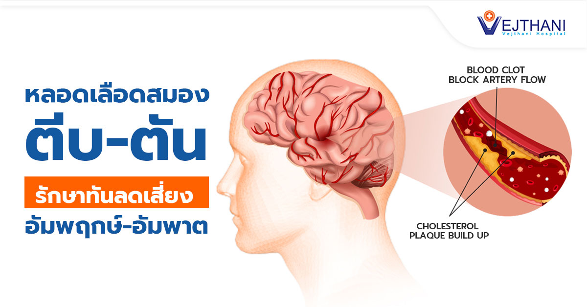 ซ่อมลิ้นหัวใจ