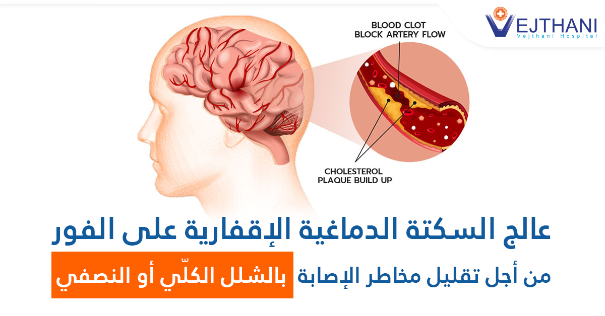 Neurosurgery