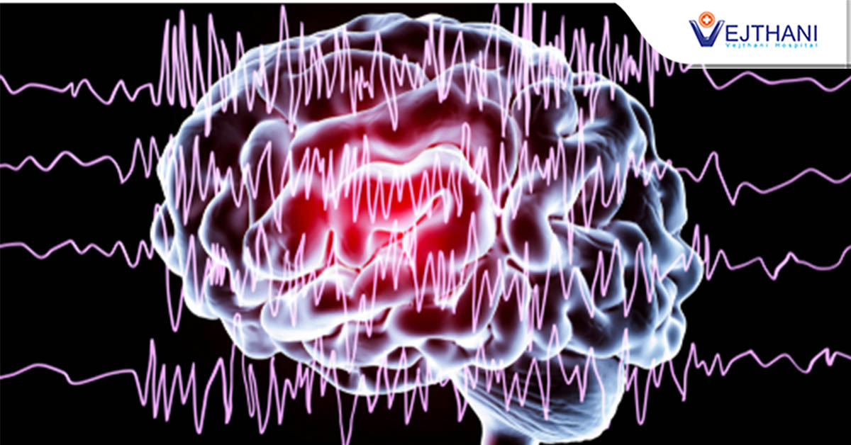 Epilepsy: Achieving High Cure Rates through Treatment