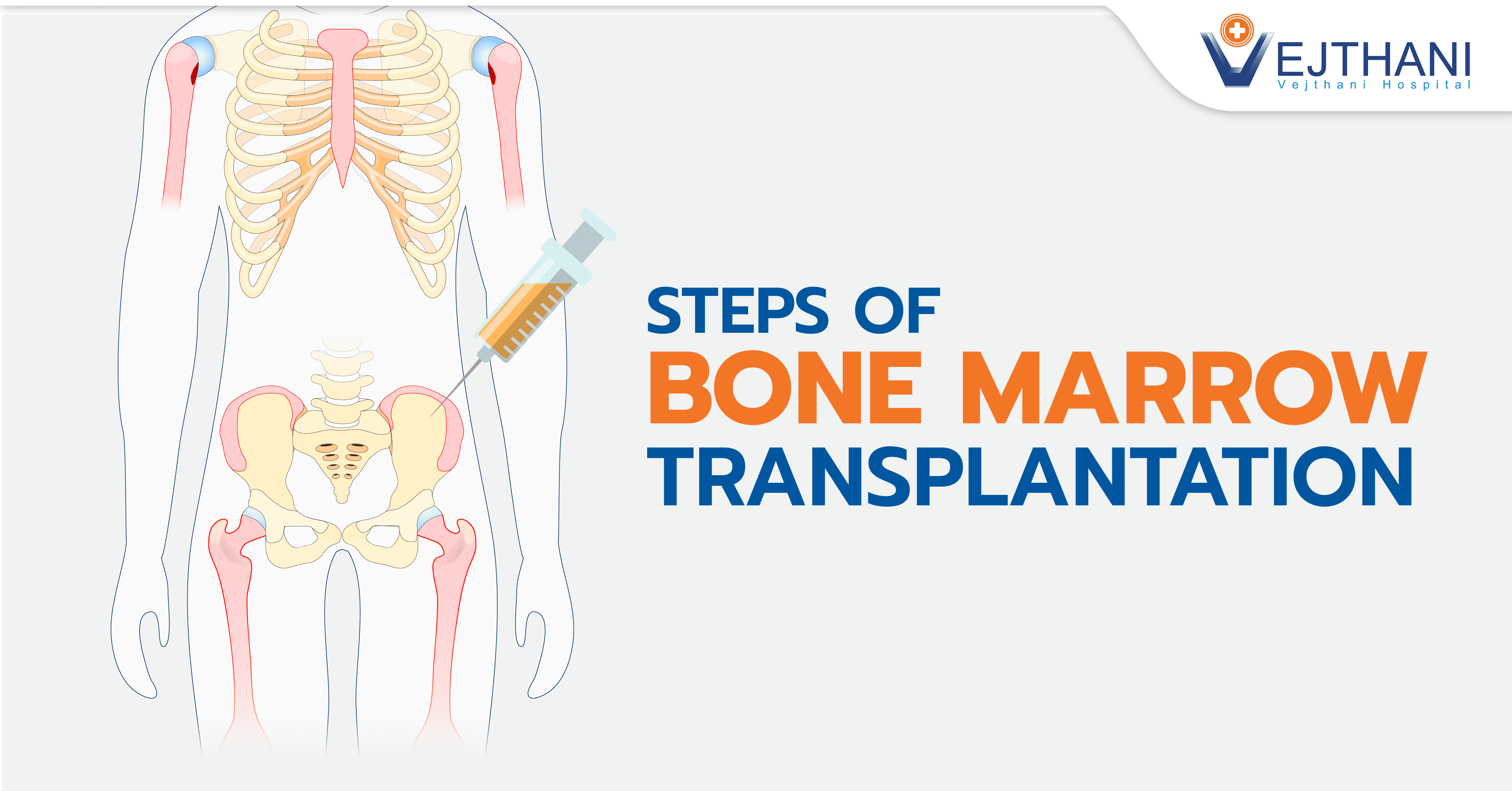 Human Bone Marrow Transplant human-bone-marrow-transplant