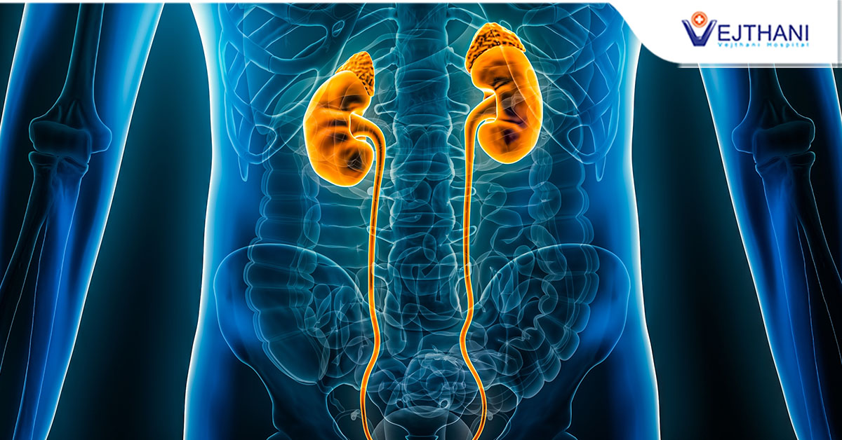 Urinary Tract Obstruction: Treat Early to Avoid Kidney Failure