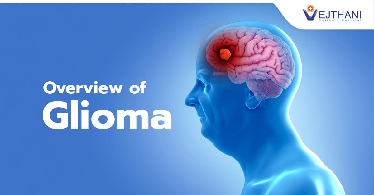 ទិដ្ឋភាពរួមនៃដុំសាច់ Glioma