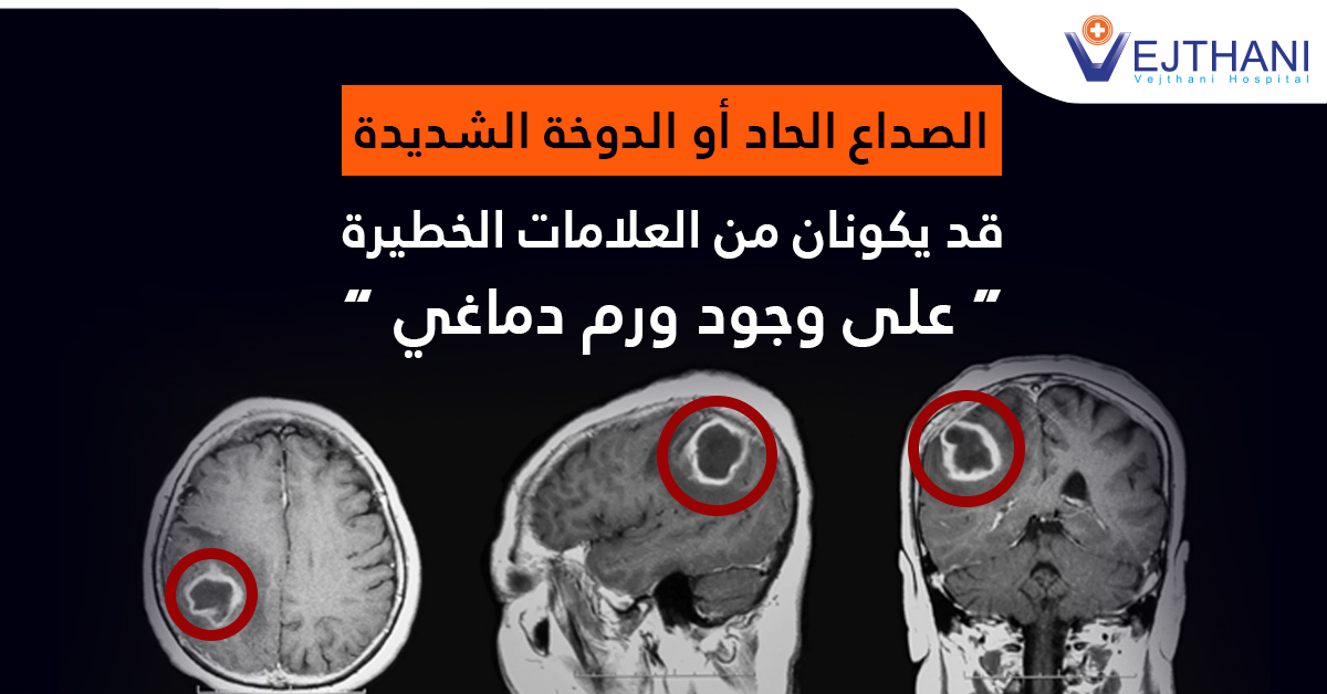 Neurosurgery