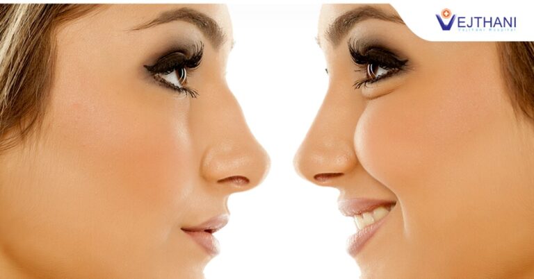 Rhinoplasty in Thailand can rid your nose of a bump